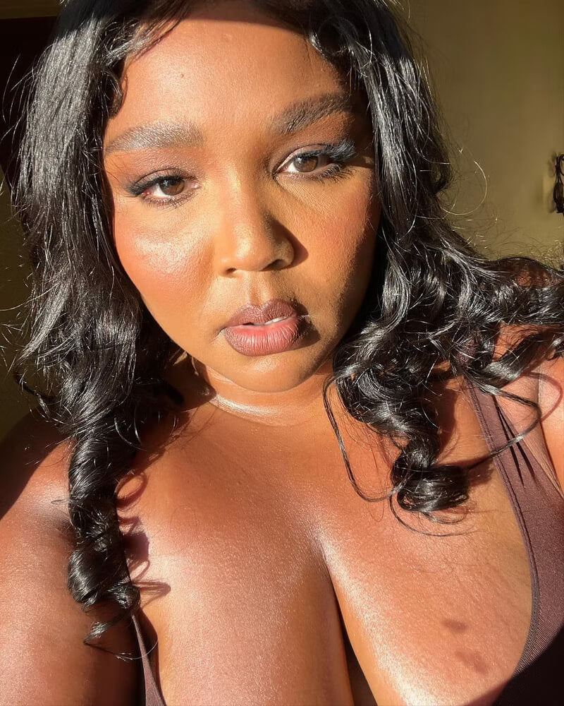 Lizzo Using Aloe Vera To Heal A Sunburn Is The Most Relatable Thing You’ll See Today