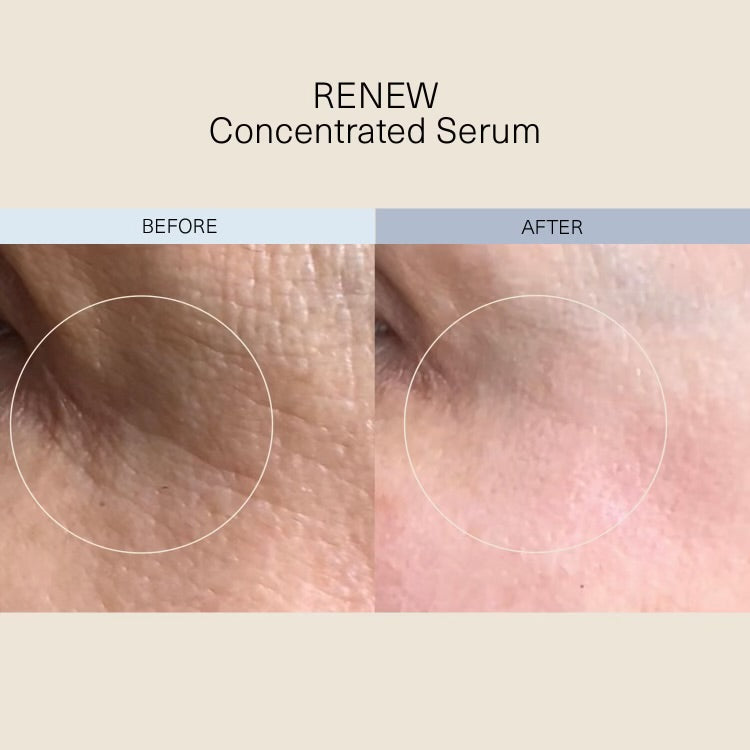 
Load image into Gallery viewer, RENEW Concentrated Serum

